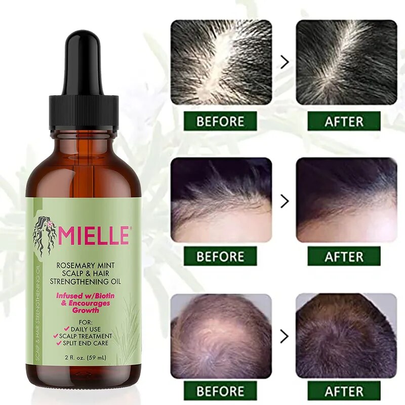 Handmade Rosemary Essential Oil 100% Pure Natural Hair Nourishing Essential Oil Premium Therapeutic Grade Premium Glass Dropper